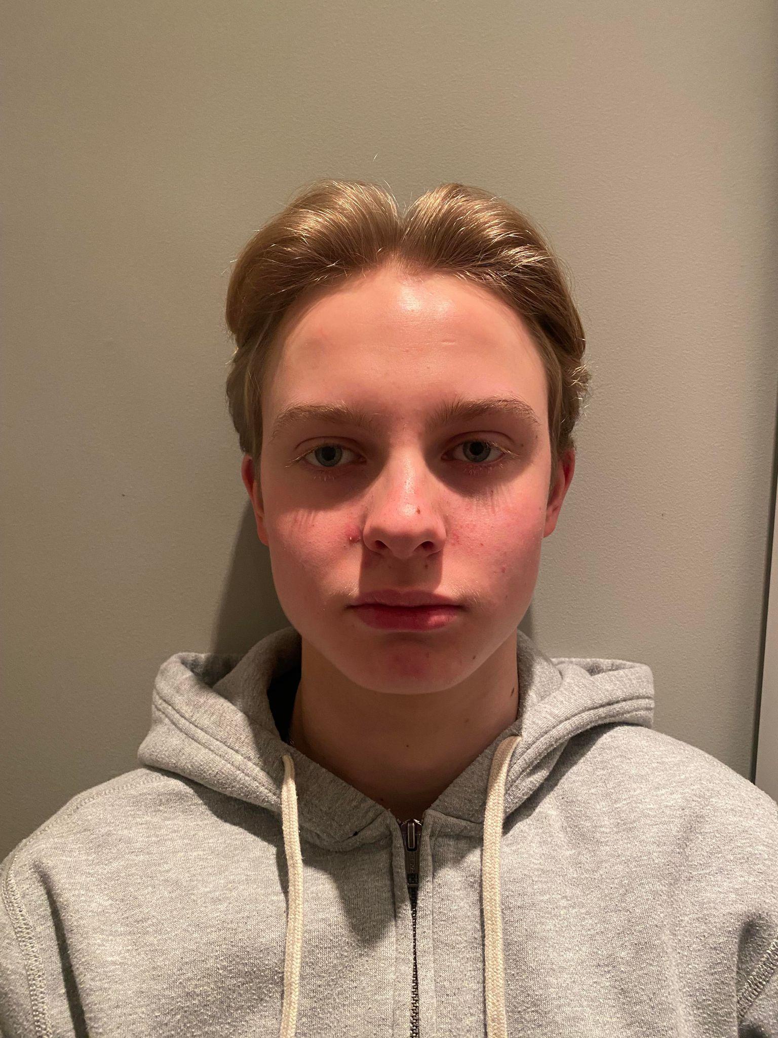 Miika KLEVSTUEN